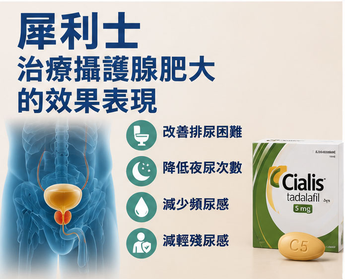 犀利士治療攝護腺肥大的效果表現